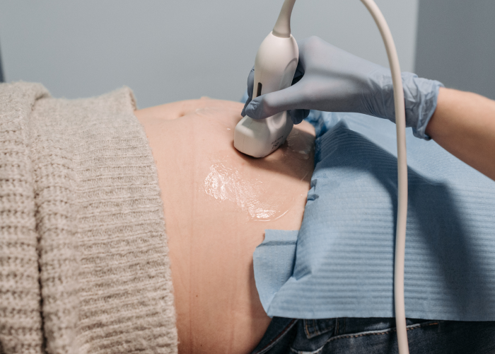 BC0E0DA0-4654-448F-81CC-60B2D2894348